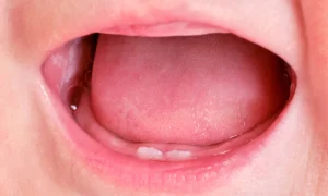 寶寶長牙順序不對怎麼辦--正常長牙